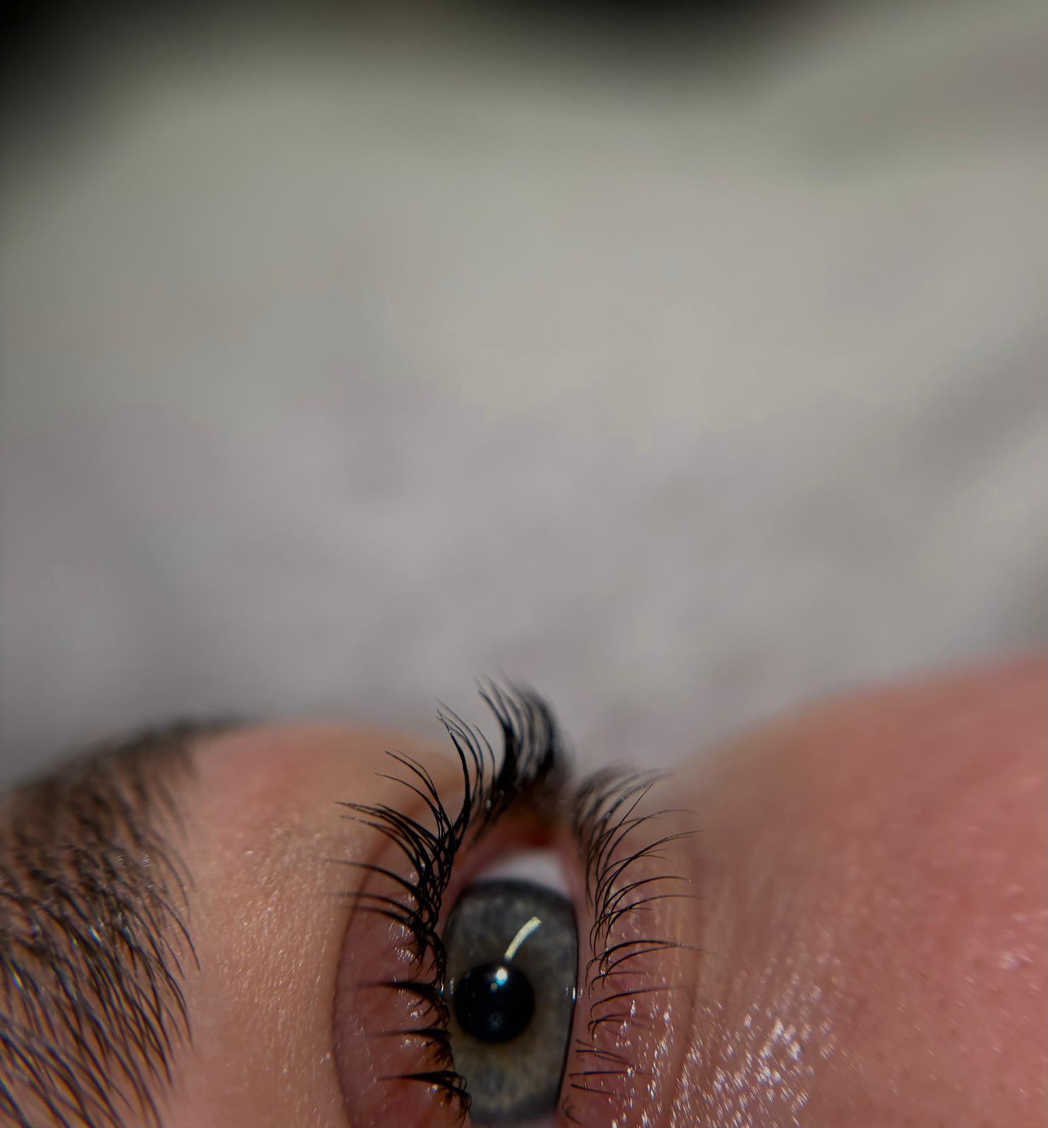Brow lift rezultat
